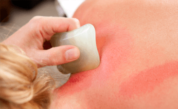 cursus-guasha-therapie